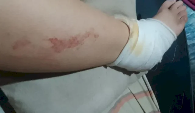 MUJER ATAQUE